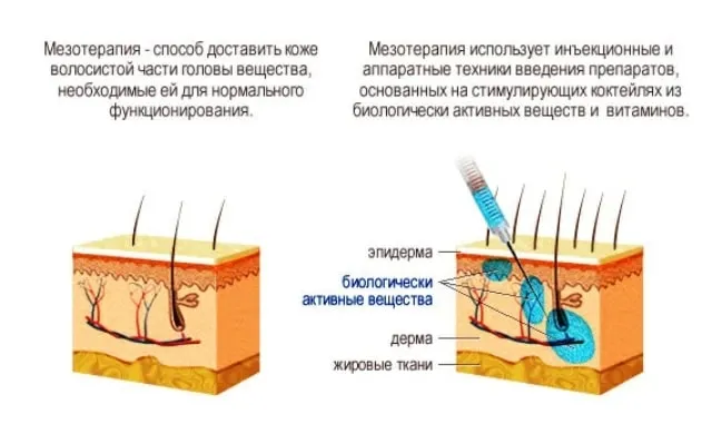 image-